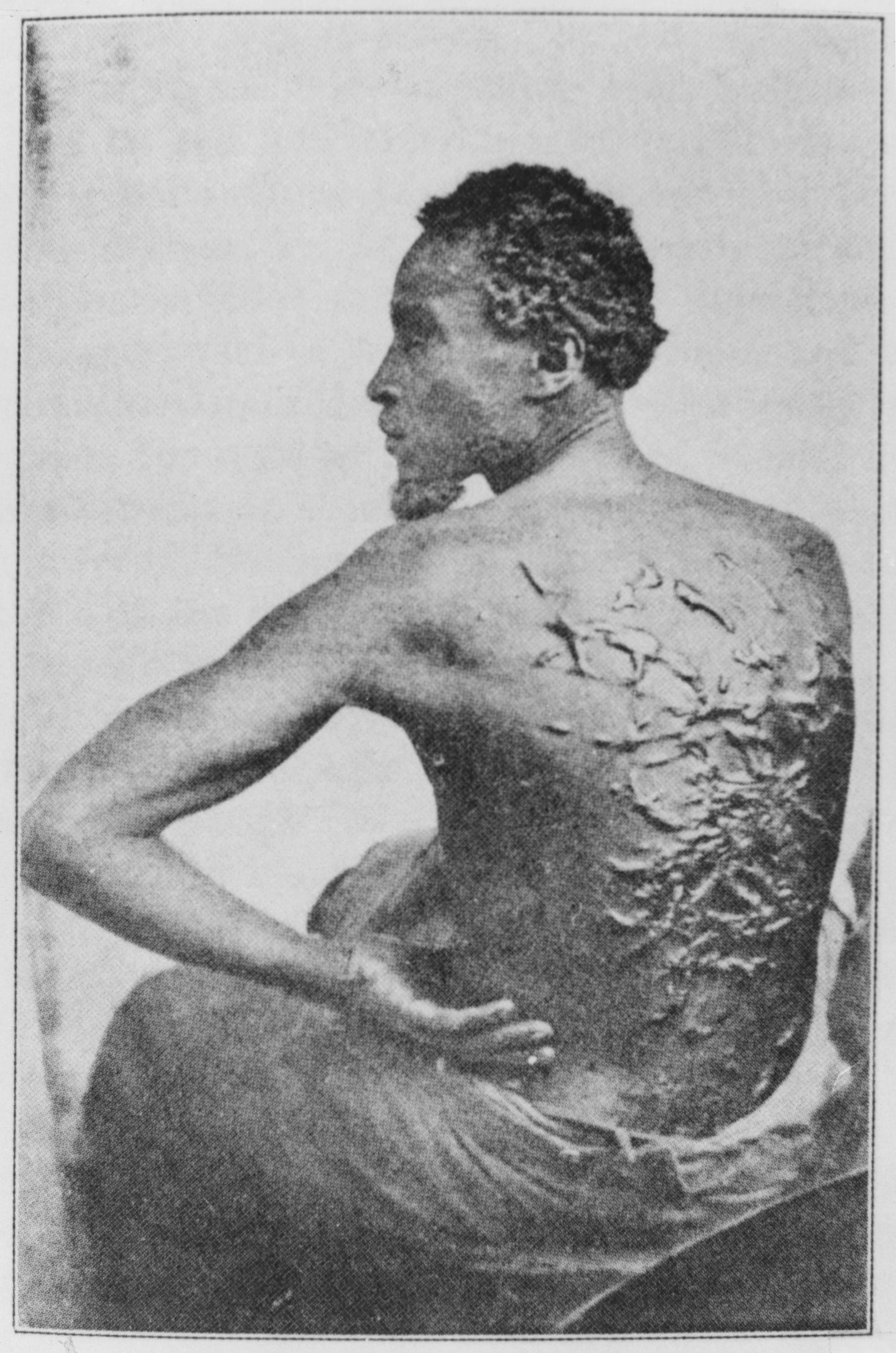 The back of a formerly enslaved African American named Gordon, photographed in 1863 after he escaped to the Union forces. Whipping was one method of punishment suffered by Black people living under bondage in the South.